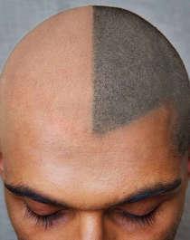 Тату на лысине