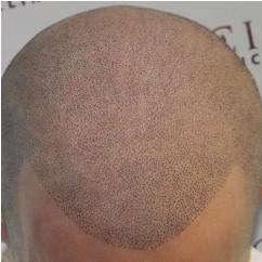 Тату на лысине