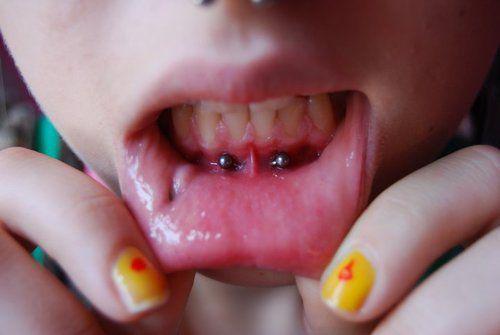 anti smiley piercing