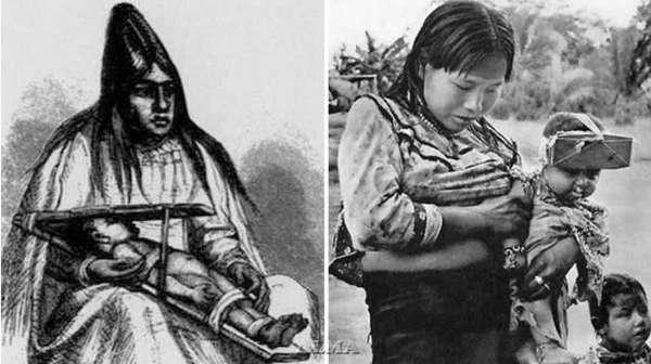 Практика искусственной деформации черепа в древнейшие времена