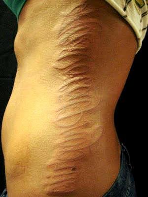 Шрамирование тату психолога не верь, не бойся, не лги, не проси