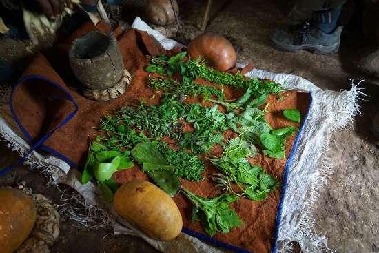 Татуировка реагирует на магниторезонансную томографию?