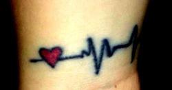 кардиостимулятор, кардиологические болезни