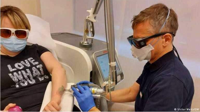 Услуга удаления татуировок сегодня